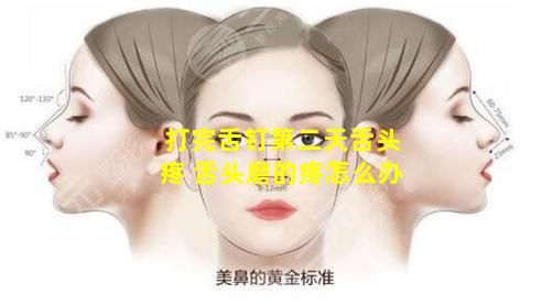 打完舌钉第二天舌头疼 舌头磨的疼怎么办
